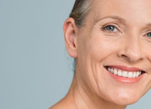 Happy older woman after wrinkle reduction treatments